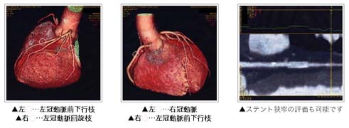 高性能な64列ＣＴで体の負担を軽減します