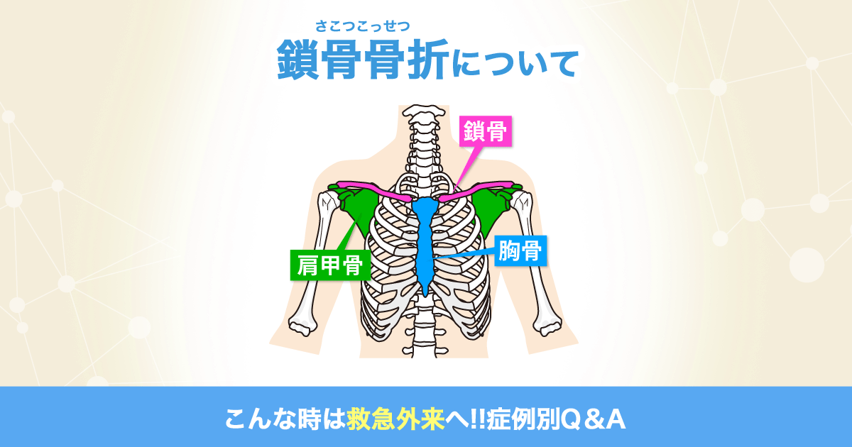 鎖骨骨折について こんな時は救急外来へ 症例別q A 社会医療法人 有隣会 東大阪病院 大阪市 城東区