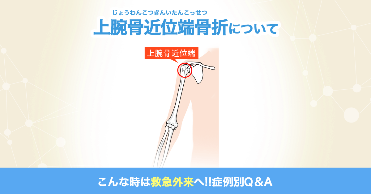 上腕骨近位端骨折について こんな時は救急外来へ 症例別q A 社会医療法人 有隣会 東大阪病院 大阪市 城東区 上腕骨近位端骨折について こんな時は救急外来へ 症例別q A 社会医療法人 有隣会 東大阪病院 大阪市 城東区