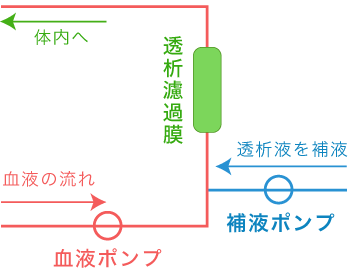 オンラインHDFの補液は透析濾過膜の前から行います。(前希釈方式)