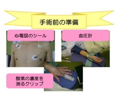 手術時の術前術後訪問について