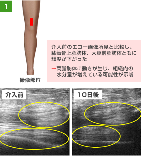 運動器エコーについて 求人のご案内 東大阪病院 リハビリテーション部門 運動器エコーについて 求人のご案内 東大阪病院 リハビリテーション部門