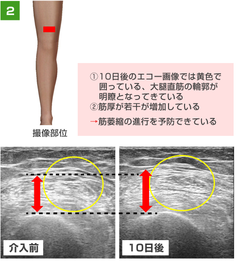 運動器エコーについて 求人のご案内 東大阪病院 リハビリテーション部門 運動器エコーについて 求人のご案内 東大阪病院 リハビリテーション部門