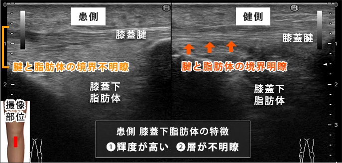 初回評価時