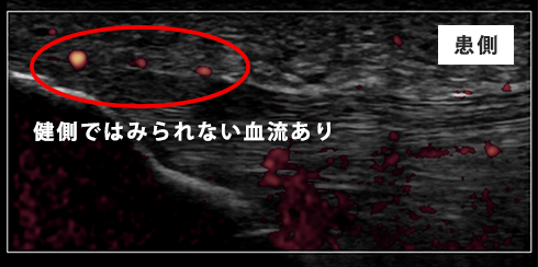 初回評価時