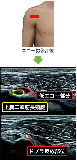 運動器エコーについて 求人のご案内 東大阪病院 リハビリテーション部門 運動器エコーについて 求人のご案内 東大阪病院 リハビリテーション部門