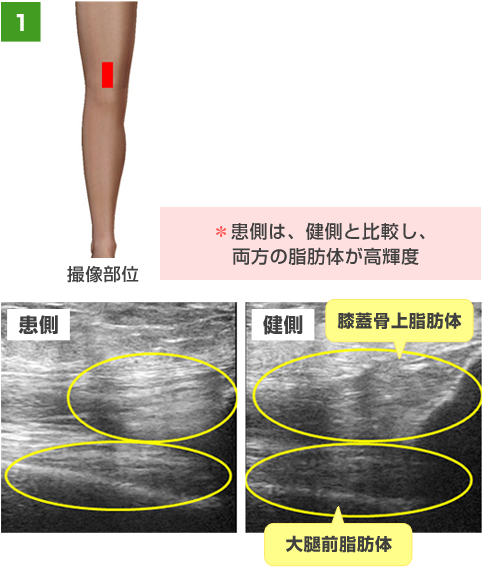 運動器エコーについて 求人のご案内 東大阪病院 リハビリテーション部門 運動器エコーについて 求人のご案内 東大阪病院 リハビリテーション部門
