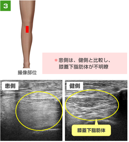 運動器エコーについて 求人のご案内 東大阪病院 リハビリテーション部門 運動器エコーについて 求人のご案内 東大阪病院 リハビリテーション部門